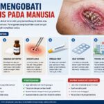 Cara Mengobati Myiasis Pada Manusia